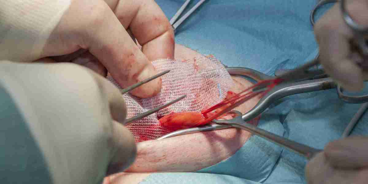 Top Hernia Surgery Hospital in Guwahati: Choose Quality Care and Reliable Solution of Hernia Repair