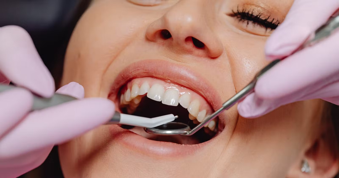 Comprehensive Range of Dental Services Offered by HCF Dentist - ProSmiles is a Top Cosmetic Dental Clinic in Collingwood
