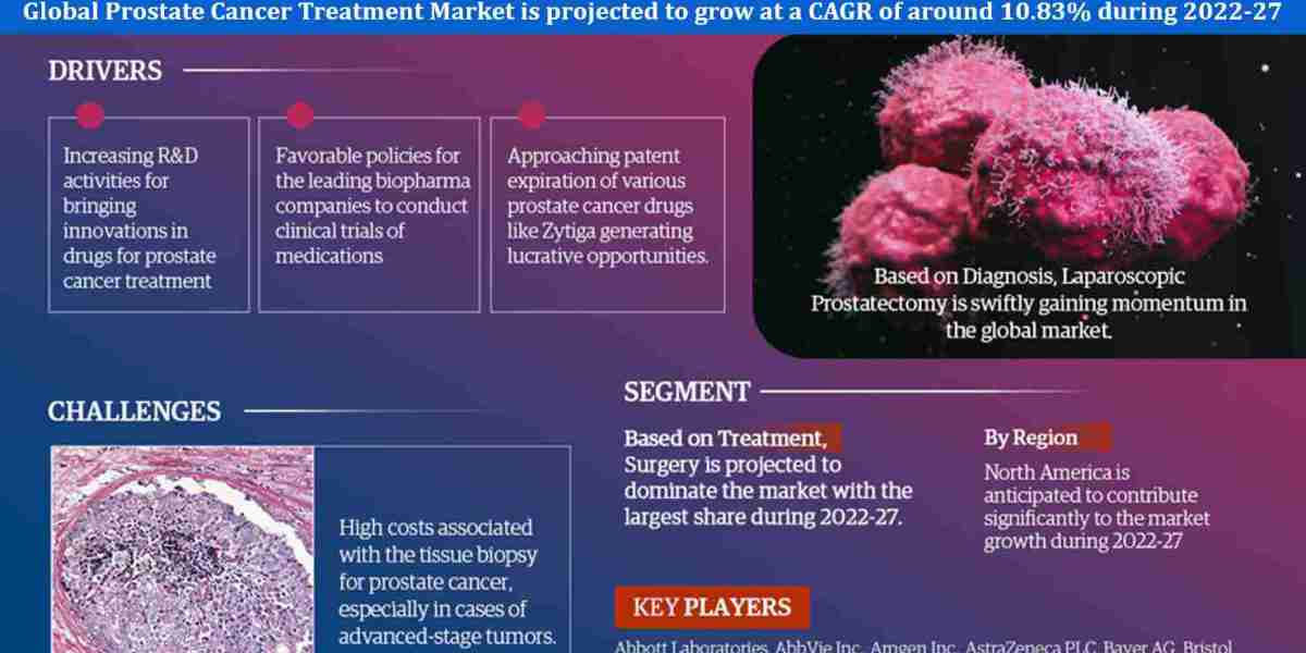 Global Prostate Cancer Treatment Market Trend, Size, Share, Trends, Growth, Report and Forecast 2022-2027