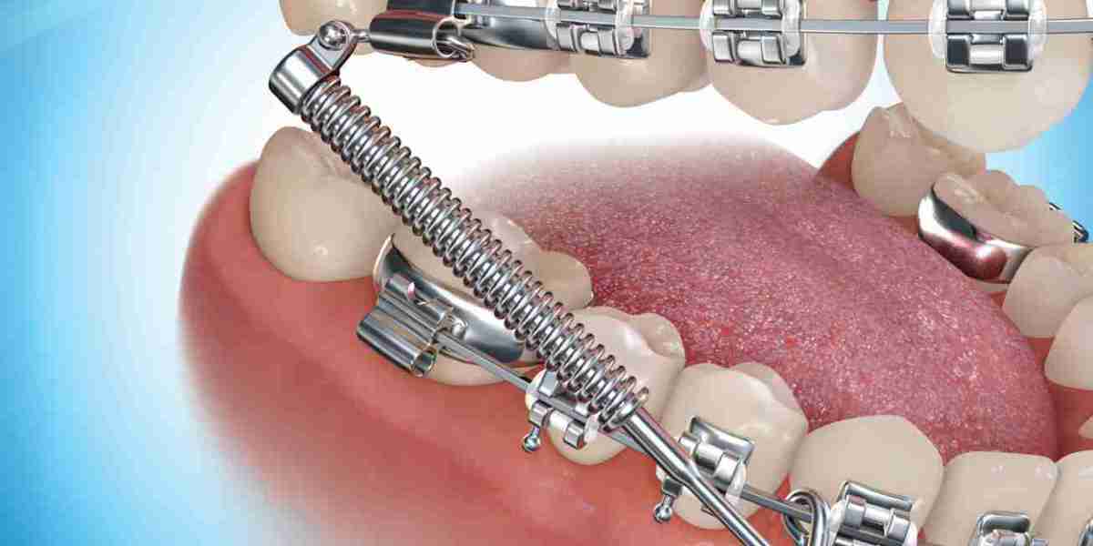 Invisible Orthodontic Appliance Market Growth, Opportunities and Development 2031