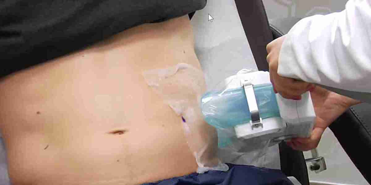 Non-Surgical Fat Reduction Market Overview, Scope, Trends and Industry Research Report 2031