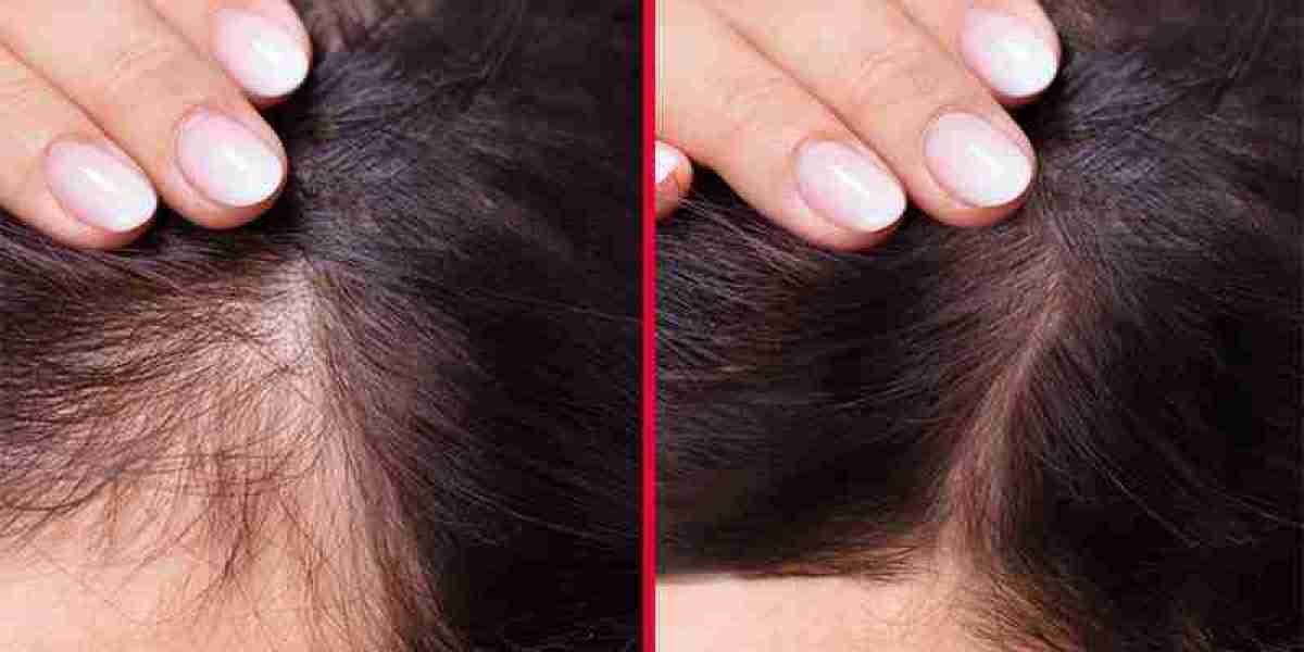 Revive and Thrive How to Find the Best Hair Serum for Damaged Hair